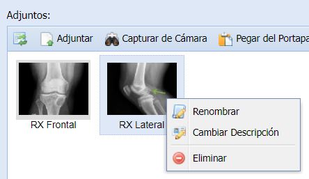 Mejoras en Archivos Adjuntos